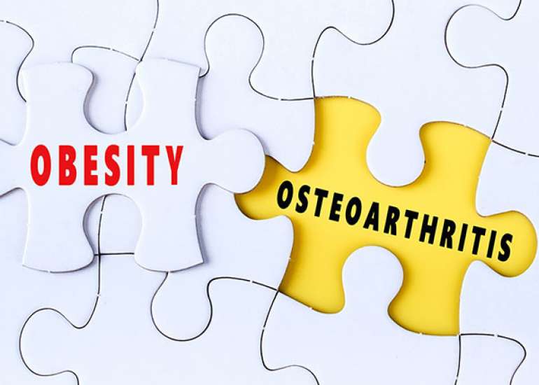 What is the link of obesity with osteoarthritis?