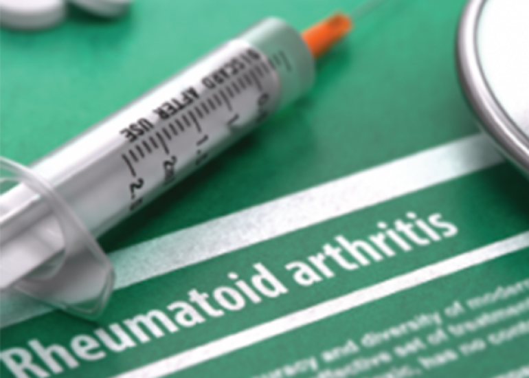 What is the treatment of Rheumatoid Arthritis?