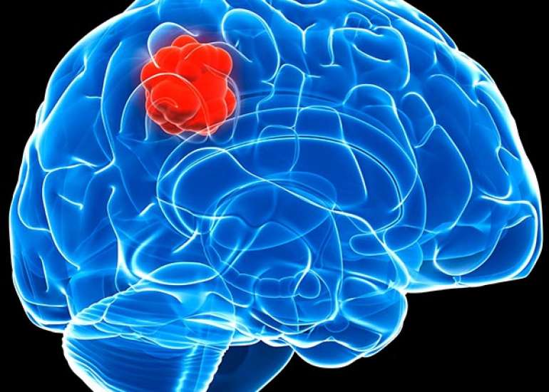 What treatment options are available for patients facing a brain tumor recurrence?