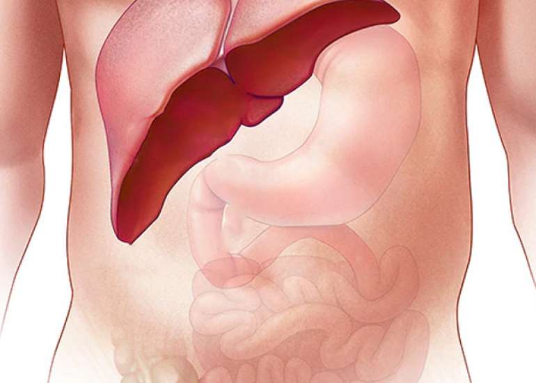 When does Wilsons disease manifest?