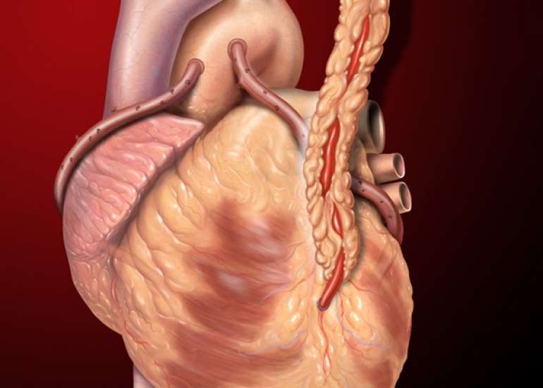 When should we go in for Bypass Surgery Recovery and Risk