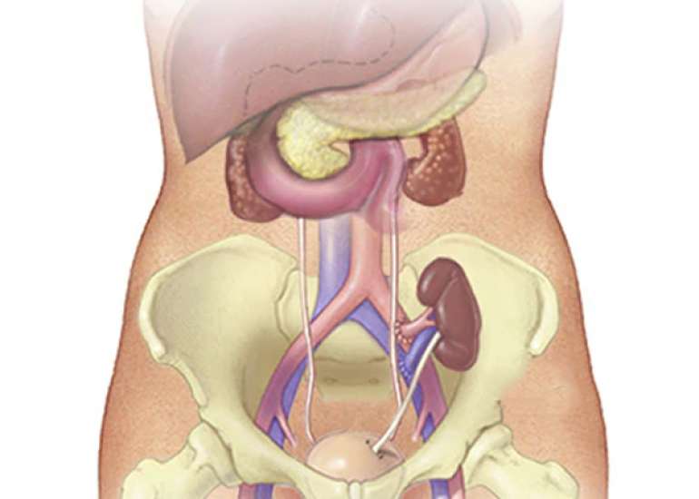 When should we send the patient for kidney transplant?