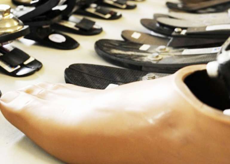 When is mechanical prosthesis required?