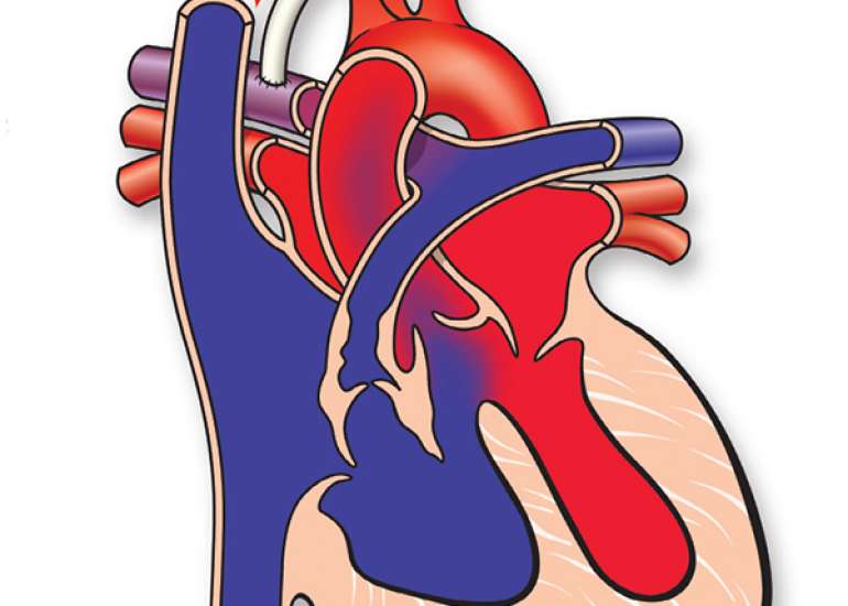 When should we correct TOF?