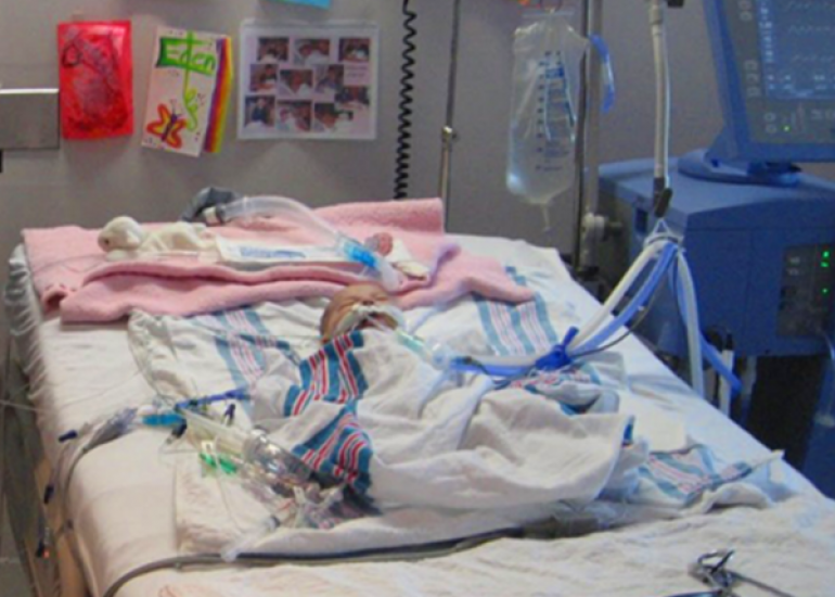 When should we operate a TGA baby?