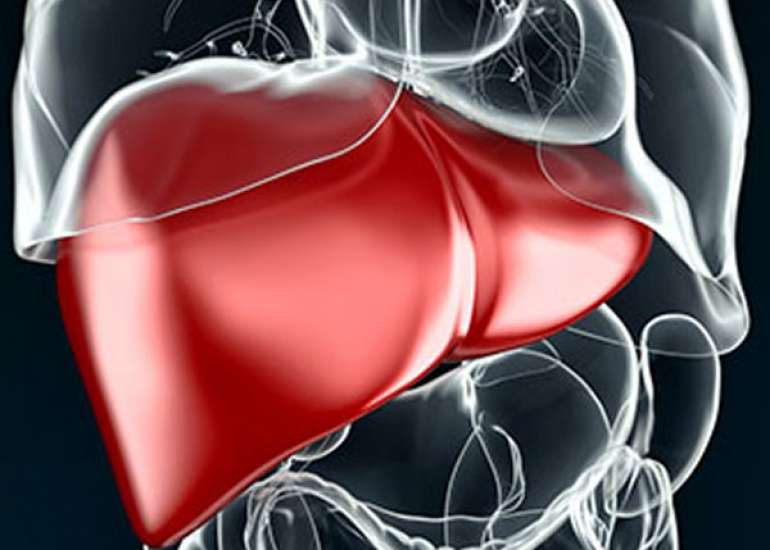 When to Suspect Liver Disorder