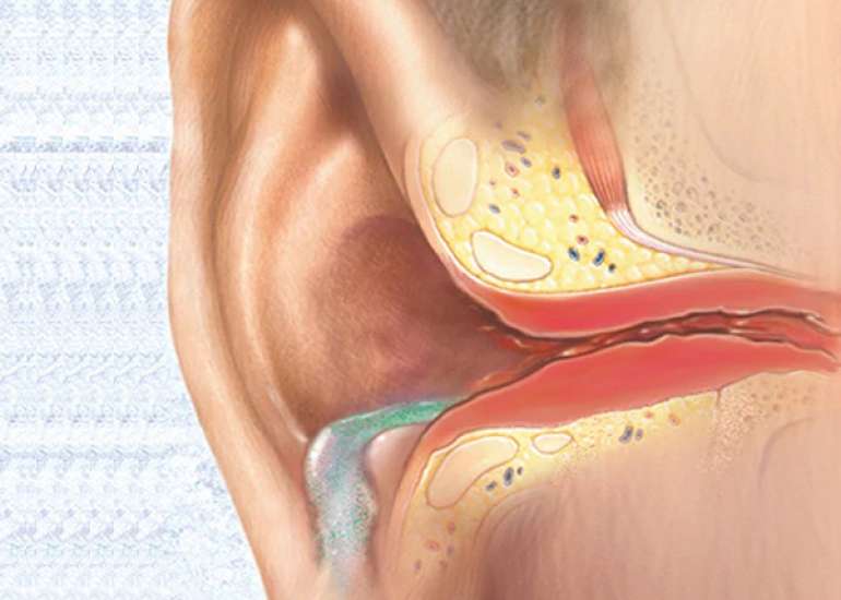 Why does the ear keep discharging even after ear surgery?