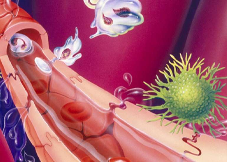 Why is mortality high in sepsis?