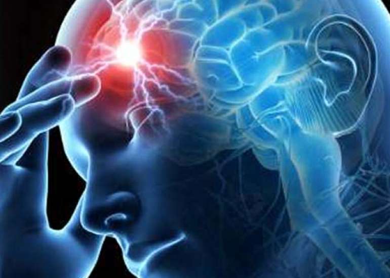 Treatment of Acute Headache