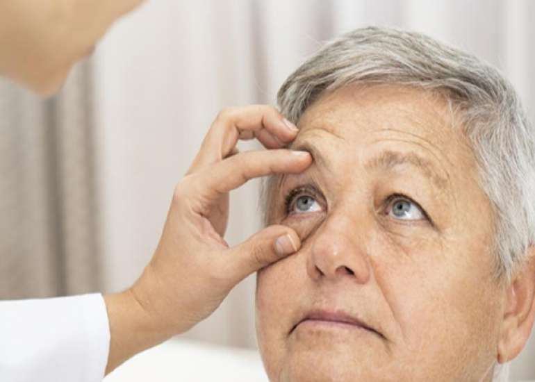 How does a doctor diagnose glaucoma?