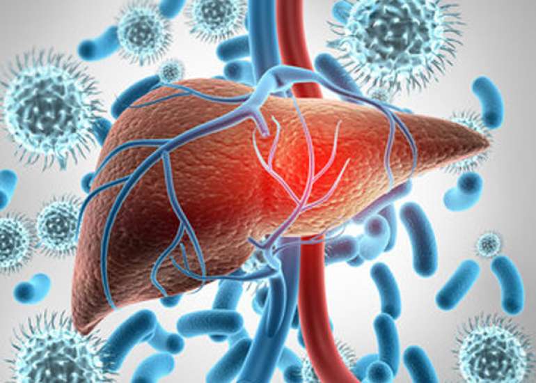 Alcoholic Hepatitis: Management and Treatment Strategies