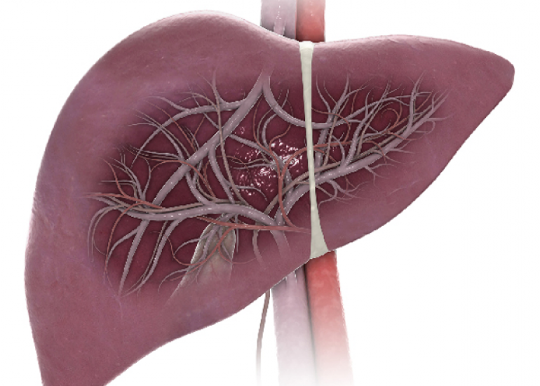 अल्कोहलिक लिवर रोग: रोग की प्रगति के लिए एसजीओटी और एसजीपीटी स्तरों की व्याख्या