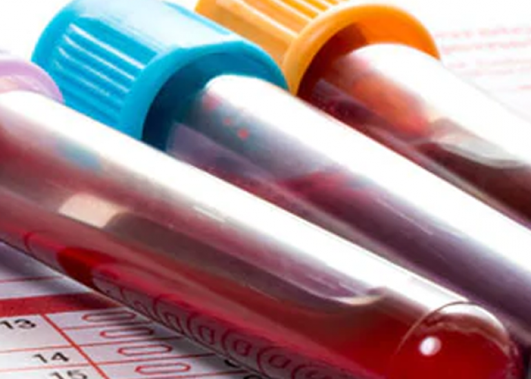 All You Should Know about SGOT and SGPT Test