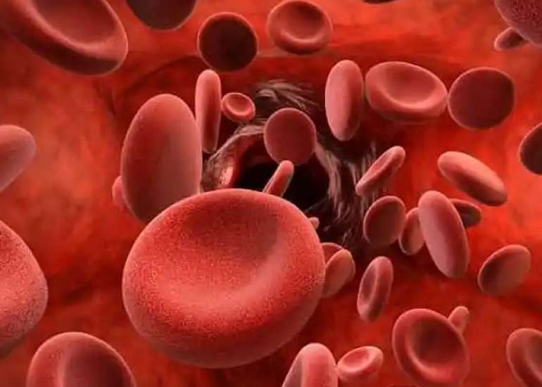 एनीमिया कितना गंभीर? लक्षण, कारण, प्रकार, और इलाज सब जाने | Anemia in Hindi