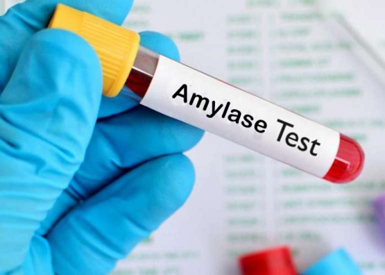 एमाइलेज टेस्ट क्या है? | Amylase Test in Hindi