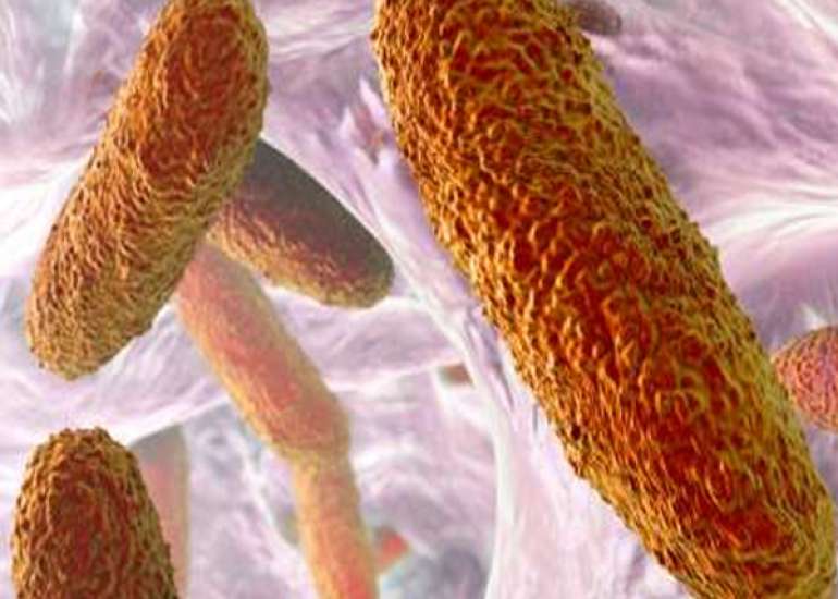 How should we manage an acute Urinary Tract Infection?