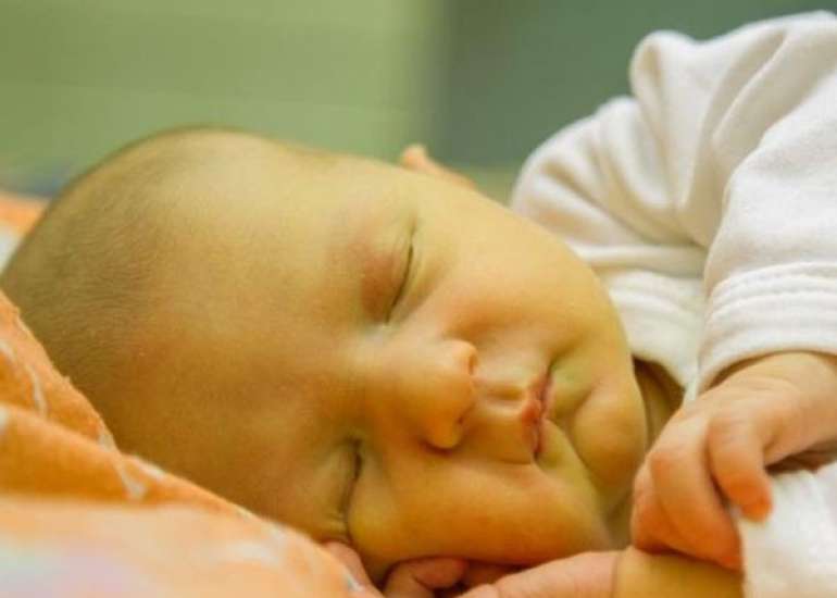 नवजात शिशुओं में पीलिया – कारण, लक्षण और इलाज | Newborn Jaundice Causes in Hindi