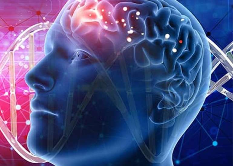 मस्तिष्क धमनीविस्फार क्या है? कारण, लक्षण और इलाज | Brain Aneurysm in Hindi