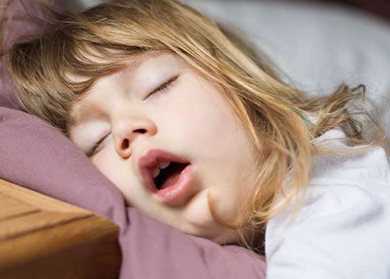 Mouth breathing and its effect on tongue?