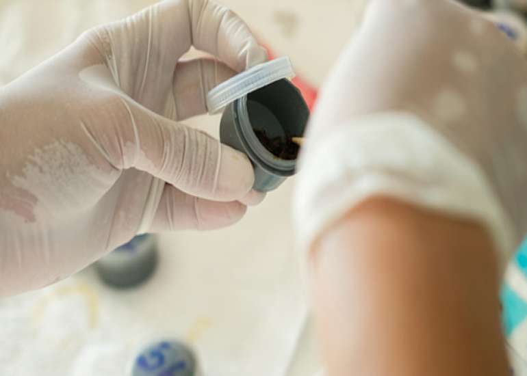 How should we collect stools for the test?