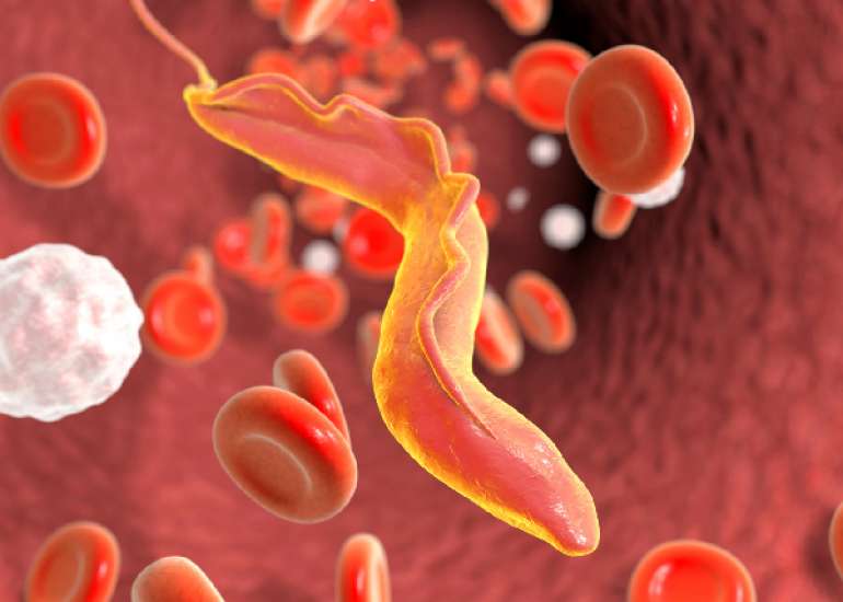 Chagas Disease: Symptoms and Treatment
