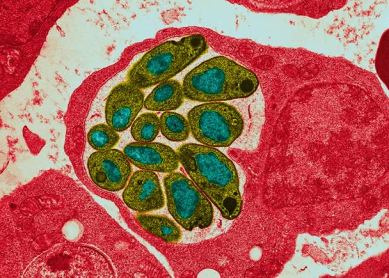 Is chloroquine resistance known in India?