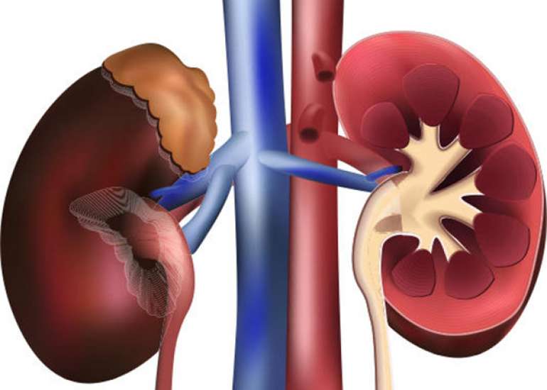 What are the common kidney questions that can be asked in exams?