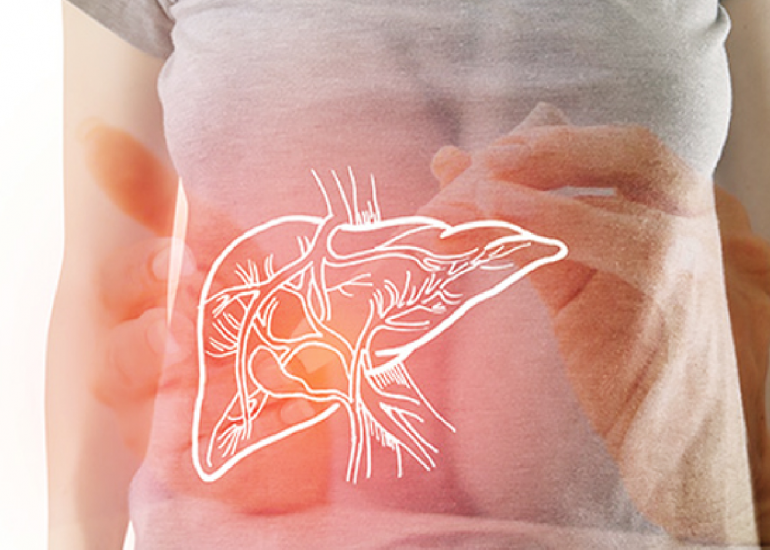 Treatment of Diabetes in Individuals with Chronic Liver Disease