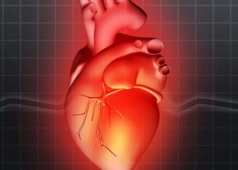 What are the complications of rheumatic heart disease?