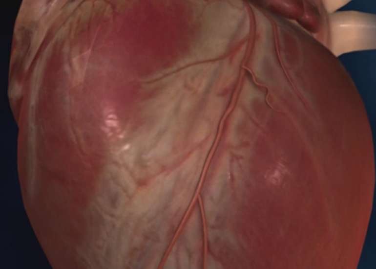 What is congestive heart failure?