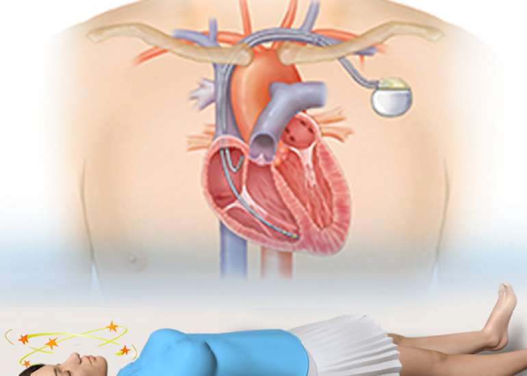 What are the clinical presentation of syncopy?