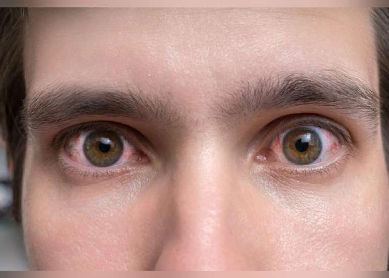 What are the common retinal diseases?