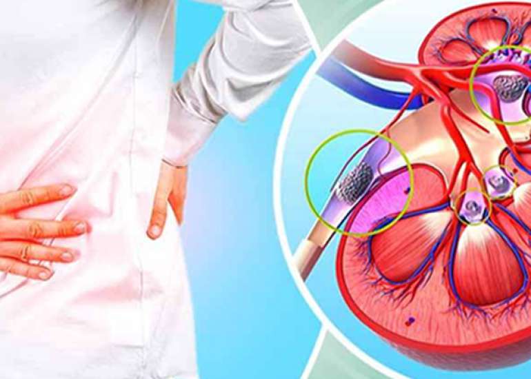 How reliable is creatinine test?