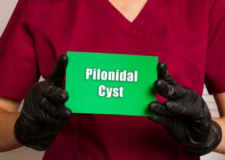 पिलोनाइडल सिस्ट क्या है? कारण, लक्षण और इलाज | Pilonidal Cyst in Hindi