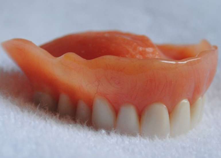 What everybody should know about dentures?