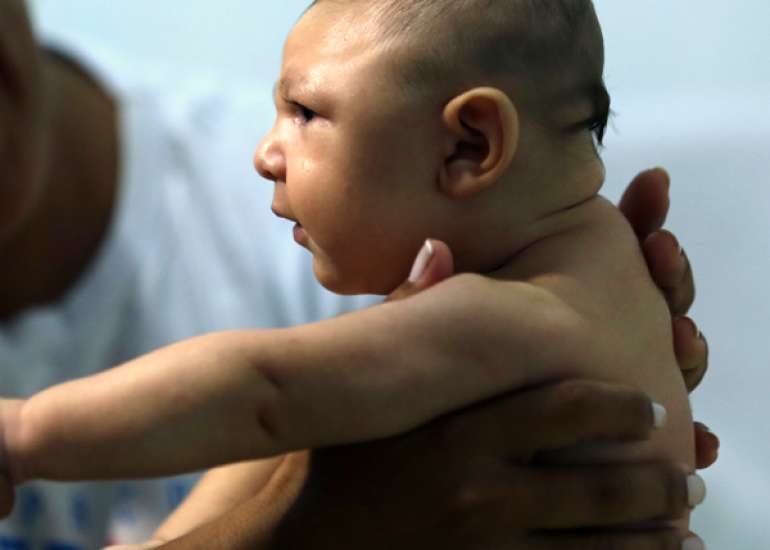 डायमंड-ब्लैकफैन एनीमिया क्या है? कारण, लक्षण और इलाज | Diamond-Blackfan Anemia in Hindi