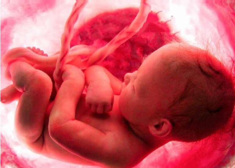 Differences in pro-inflammatory responses between preterm and term infant cord blood