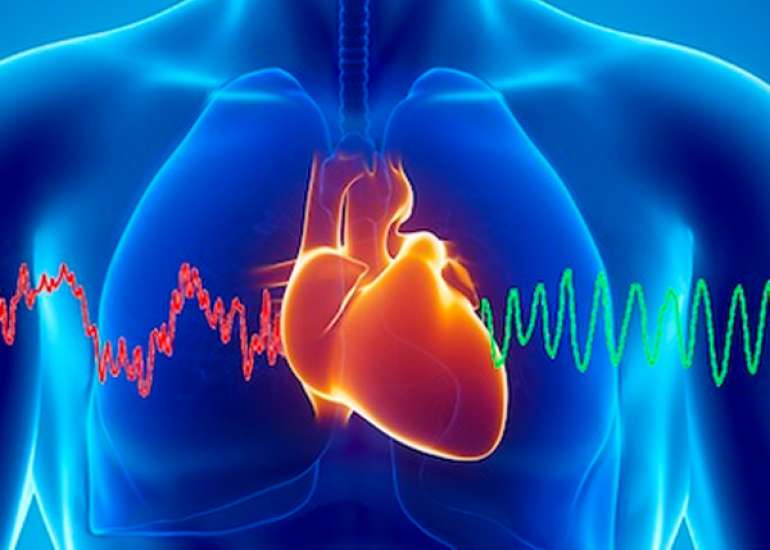 What is the role of dipyridamole in acute MI?