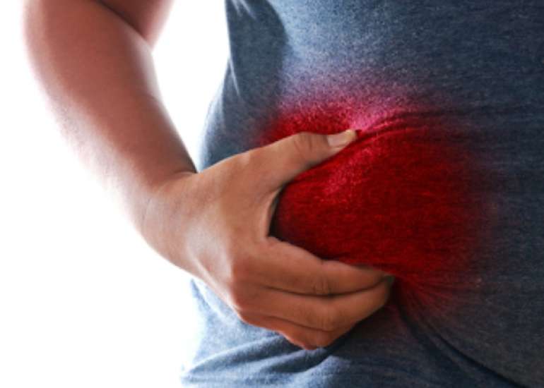 Fatty Liver Disease: All you need to know