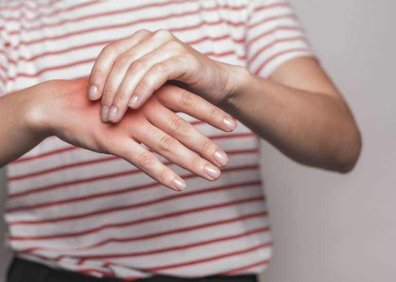 एडिमा क्या है? कारण, लक्षण और इलाज | Edema in Hindi 