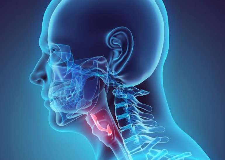 एपिग्लोटाइटिस क्या है? कारण, लक्षण और इलाज | Epiglottitis in Hindi