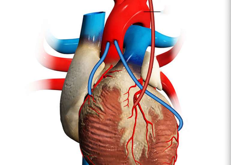 How many times can we undergo a bypass surgery?