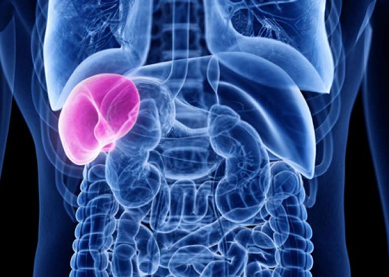 गौचर रोग क्या है? कारण, लक्षण और इलाज | Gaucher Disease in Hindi