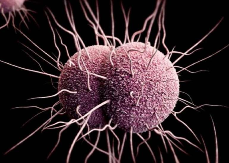 गोनोरिया क्या है?  कारण, लक्षण और इलाज | What is gonorrhea?  Causes, Symptoms and Treatment