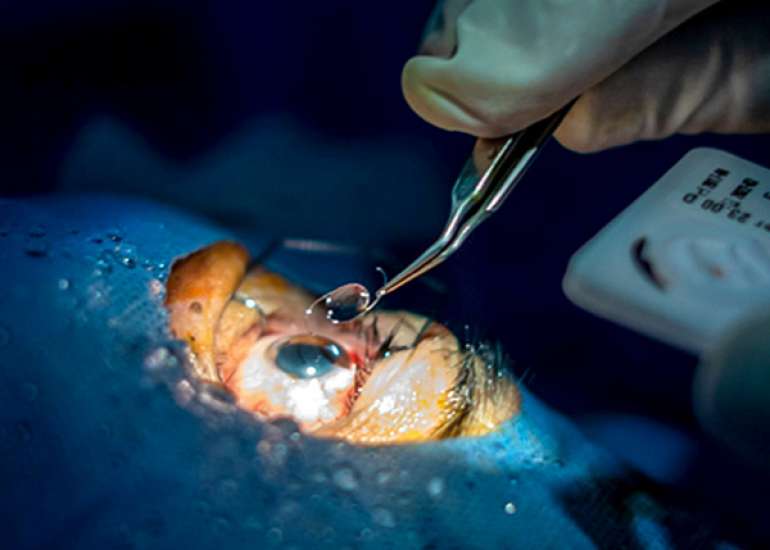 How should we manage glaucoma surgically and what are the indications of surgery?