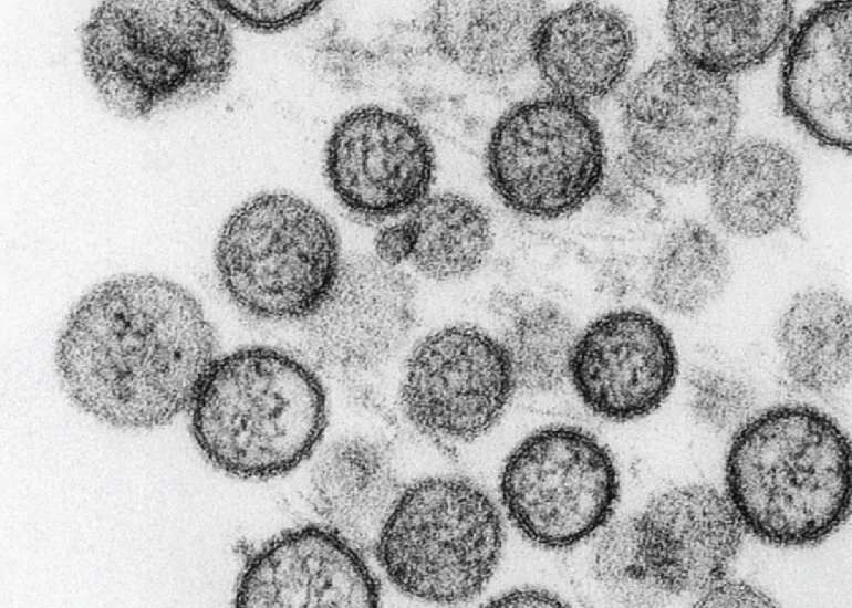 क्या है हंता वायरस, कैसे फैलता है और क्या है इसके लक्षण ?