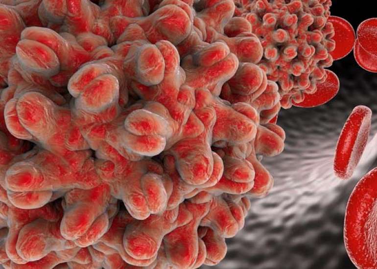 Hepatitis B: Causes, Transmission, and Prevention Strategies