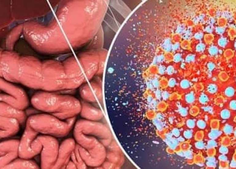 हेपेटाइटिस ई क्या है? कारण, लक्षण और इलाज | What is Hepatitis E in Hindi