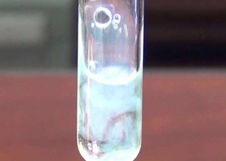 What is 24 hours urine albumin test?