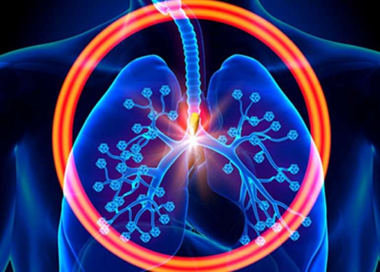 हाइपरकेपनिया क्या है? कारण, लक्षण और इलाज | Hypercapnia in Hindi